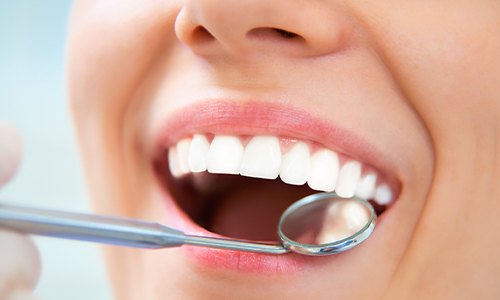 Closeup of smile during dental exam