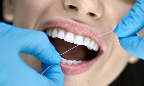 Closeup of dentist flossing woman's teeth