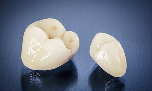 Two dental crowns prior to placement