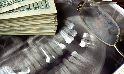 money on a dental xray