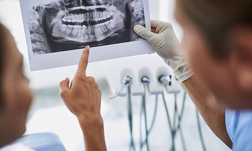 Dentist explaining cost of dental implants in Big Pine Key