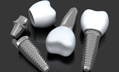 Three animated dental implants