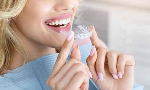 Female orthodontic patient about to put in Invisalign aligner