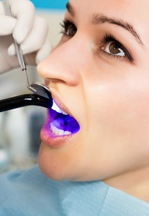 Dentist applying bonding to woman’s damaged tooth
