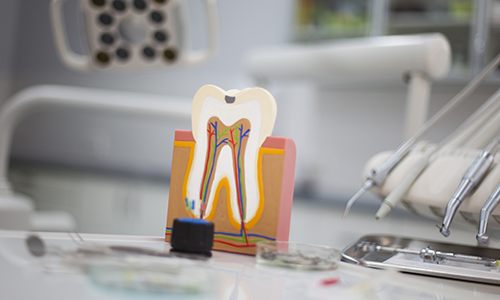 Model of the inside of a healthy tooth