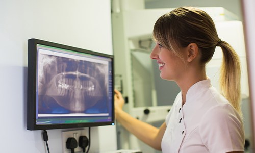 Panoramic dental x-rays